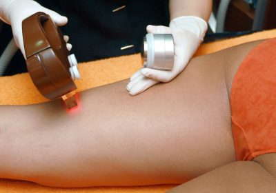 Épilation au laser – Un cadre pour mieux informer les clients